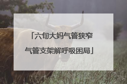 六旬大妈气管狭窄 气管支架解呼吸困局